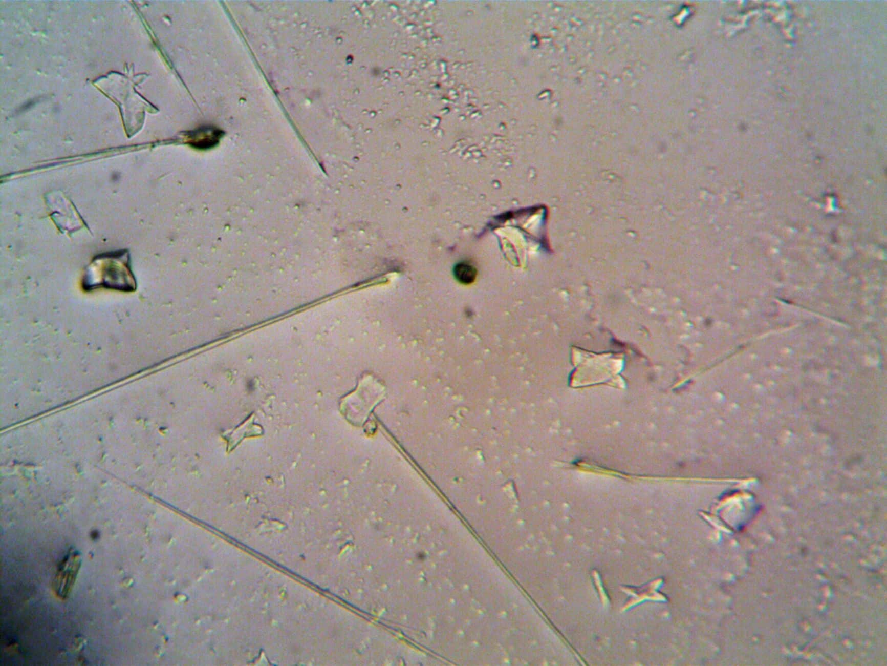 Microscopic view of particles and textures resembling silver paste used in solar cell contacts